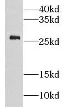 GSTA1 Rabbit Polyclonal Antibody