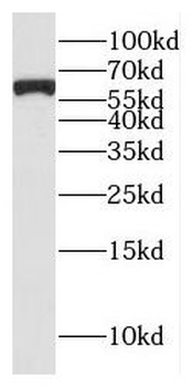 GTF2H1 Rabbit Polyclonal Antibody