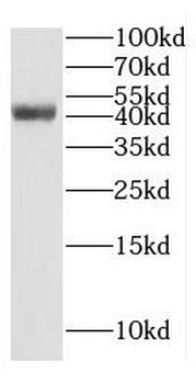 GTF2H2C Rabbit Polyclonal Antibody