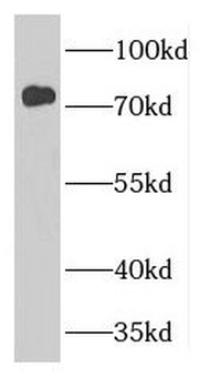 GTPBP4 Rabbit Polyclonal Antibody
