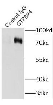 GTPBP4 Rabbit Polyclonal Antibody