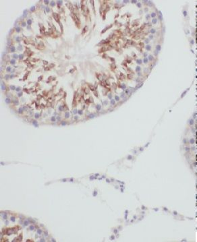 GTPBP4 Rabbit Polyclonal Antibody