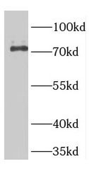 GTSE1 Rabbit Polyclonal Antibody