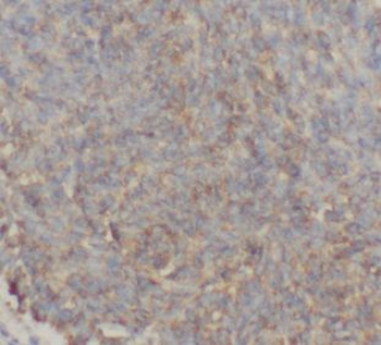 GTSE1 Rabbit Polyclonal Antibody