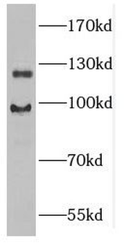 GUCY2D Rabbit Polyclonal Antibody