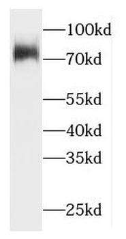 HACE1 Rabbit Polyclonal Antibody