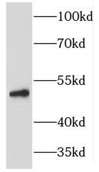 HARS1 Rabbit Polyclonal Antibody