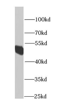 HARS2 Rabbit Polyclonal Antibody