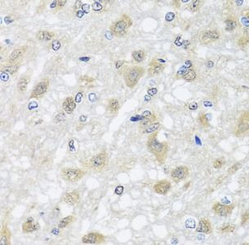 HARS2 Rabbit Polyclonal Antibody
