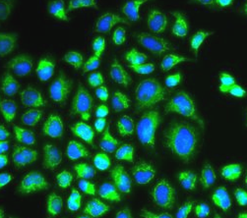 HAX1 Rabbit Polyclonal Antibody
