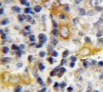 HAX1 Rabbit Polyclonal Antibody