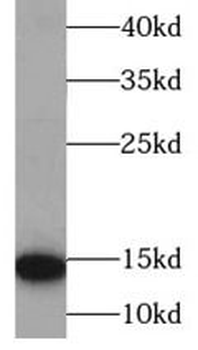 HBB Rabbit Polyclonal Antibody