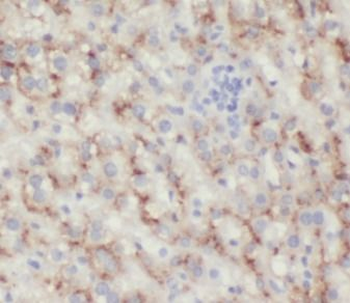 HBB Rabbit Polyclonal Antibody