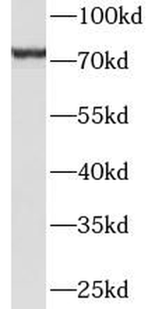 HBS1L Rabbit Polyclonal Antibody