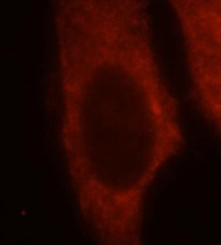 HBS1L Rabbit Polyclonal Antibody