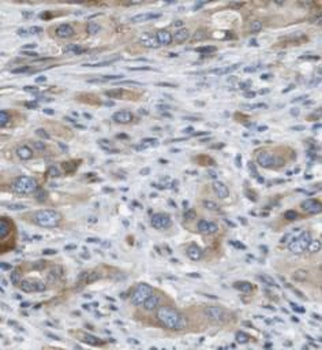 HBS1L Rabbit Polyclonal Antibody