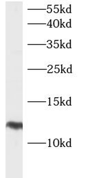 LAMTOR5 Rabbit Polyclonal Antibody