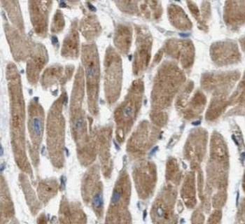 HCN1 Rabbit Polyclonal Antibody