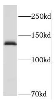 HCN4 Rabbit Polyclonal Antibody
