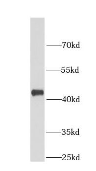 HDAC8 Rabbit Polyclonal Antibody