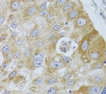 HDAC8 Rabbit Polyclonal Antibody