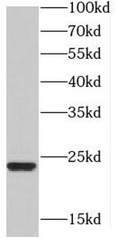 HDDC2 Rabbit Polyclonal Antibody