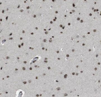 HDDC2 Rabbit Polyclonal Antibody