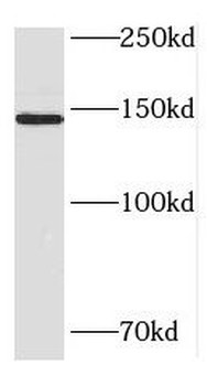 HDLBP Rabbit Polyclonal Antibody