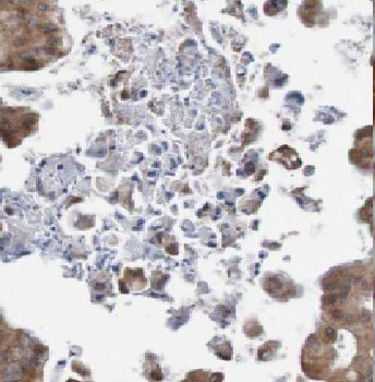 WFDC2 Rabbit Polyclonal Antibody