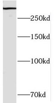 HECTD1 Rabbit Polyclonal Antibody