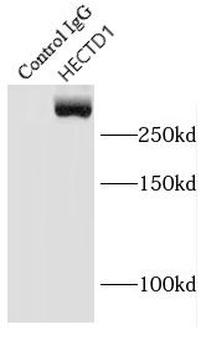 HECTD1 Rabbit Polyclonal Antibody