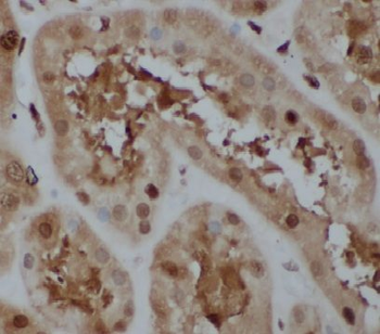 HECTD1 Rabbit Polyclonal Antibody