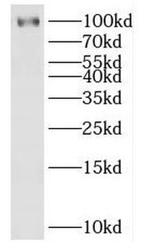 HECTD3 Rabbit Polyclonal Antibody