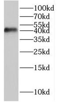HES5 Rabbit Polyclonal Antibody