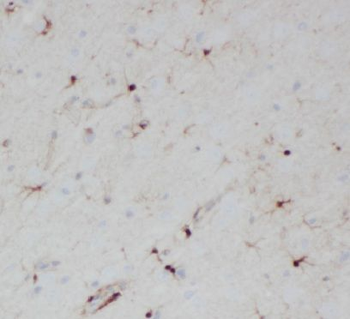 HES5 Rabbit Polyclonal Antibody