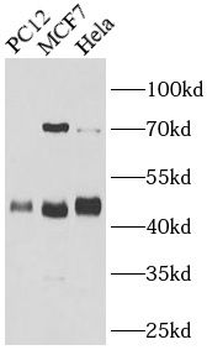 HEXIM1 Rabbit Polyclonal Antibody