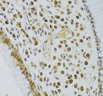 HEXIM1 Rabbit Polyclonal Antibody