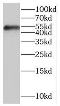 HFE Rabbit Polyclonal Antibody