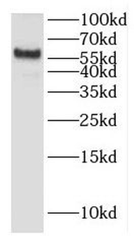 HINFP Rabbit Polyclonal Antibody