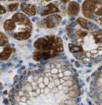 HIVEP1 Rabbit Polyclonal Antibody
