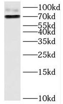 HJURP Rabbit Polyclonal Antibody