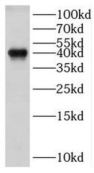 HLA E Rabbit Polyclonal Antibody