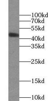 HLA F Rabbit Polyclonal Antibody