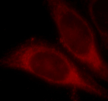 HMGCS1 Rabbit Polyclonal Antibody