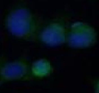 HMOX1 Rabbit Polyclonal Antibody