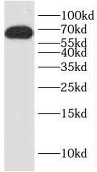 HNF1A Rabbit Polyclonal Antibody