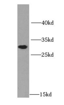 HNMT Rabbit Polyclonal Antibody