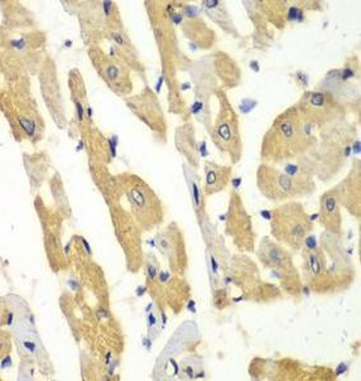 HNMT Rabbit Polyclonal Antibody