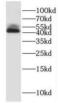 HNRNPF Rabbit Polyclonal Antibody