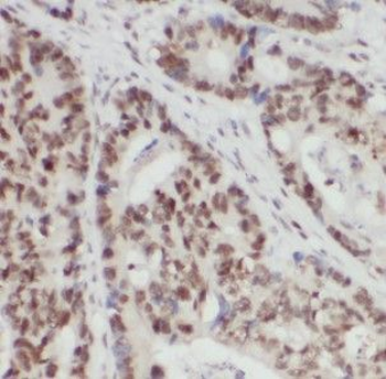 HNRNPF Rabbit Polyclonal Antibody